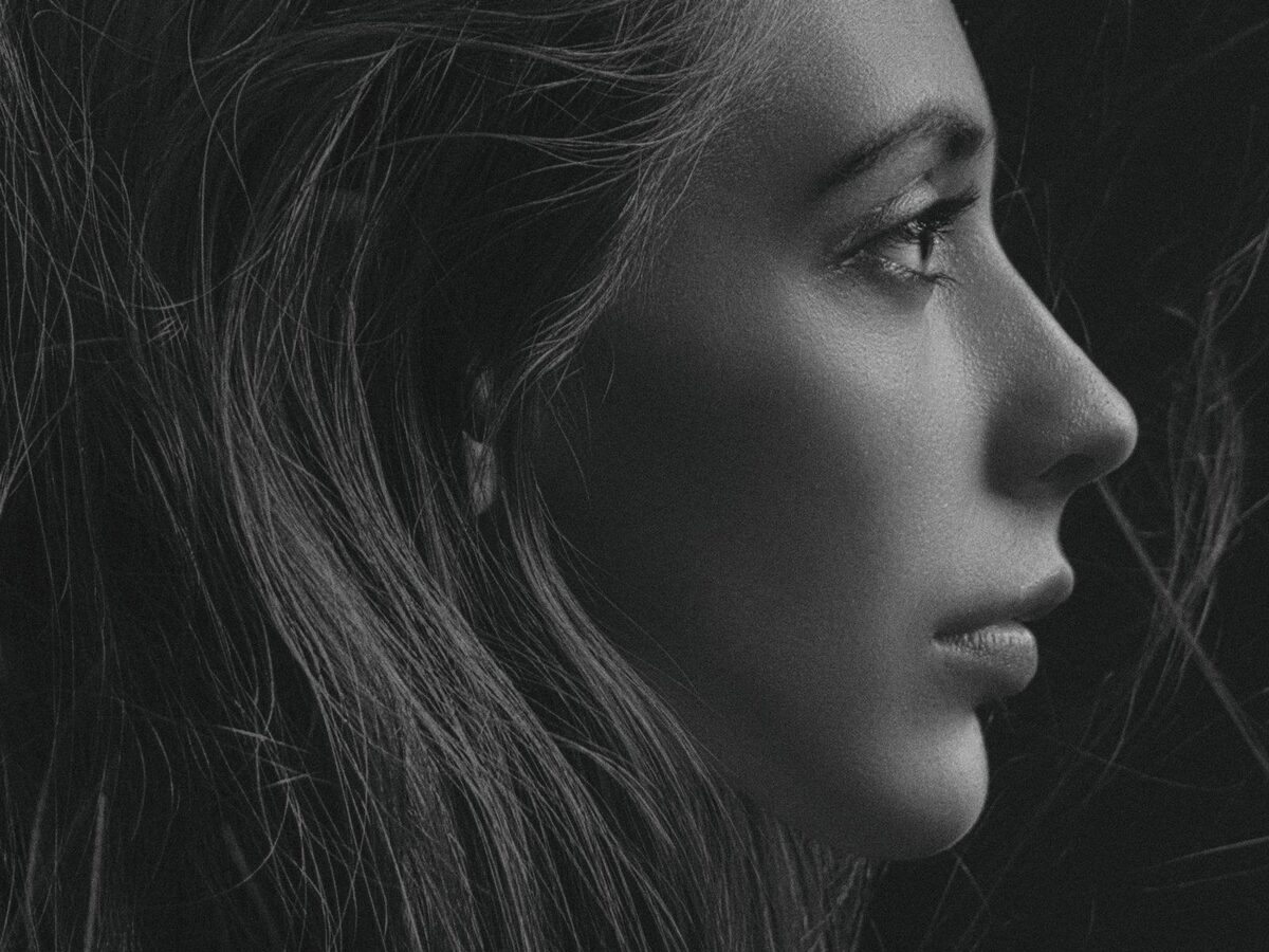 Perfil facial que ilustra la rinoplastia en DrReyes